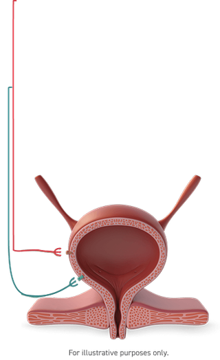Bladder, Diagram
